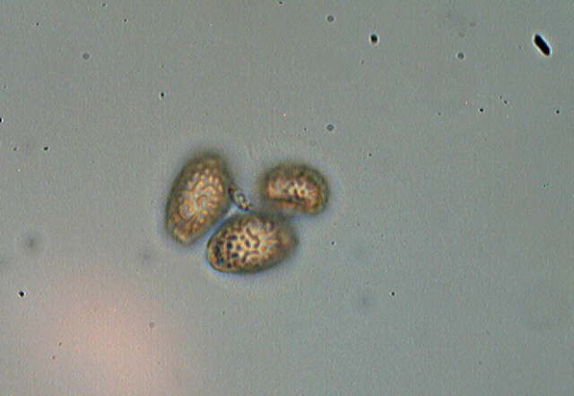 Spore Geopora sumneriana con Wild fluotar 40 X